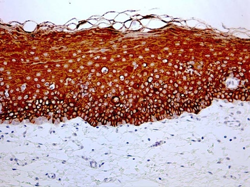 IHC of Cytokeratin 4 on an FFPE Oral Mucosa Tissue